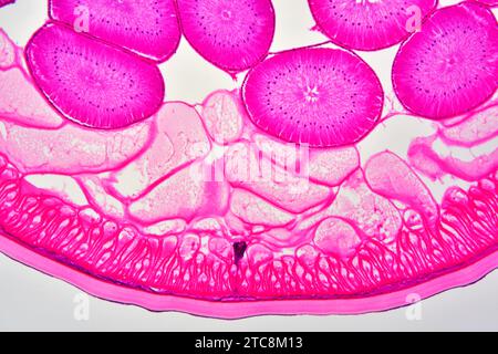 Ascaris lumbricoides femelle montrant la cuticule, l'épithélium, le canal excréteur, le pseudocoelome et les ovaires. Microscope optique X150 à 10 cm de large. Banque D'Images