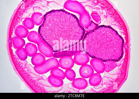 Ascaris lumbricoides femelle montrant la cuticule, l'épithélium, les muscles longitudinaux, le pseudocoelome, les ovaires, utérus et intestin. Microscope optique X50 à 10 Banque D'Images