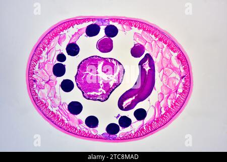 Ascaris lumbricoides mâle montrant cuticule, épithélium, muscles longitudinaux, canal excréteur, cordon nerveux dorsal et ventral, pseudocoelome, ves séminaux Banque D'Images