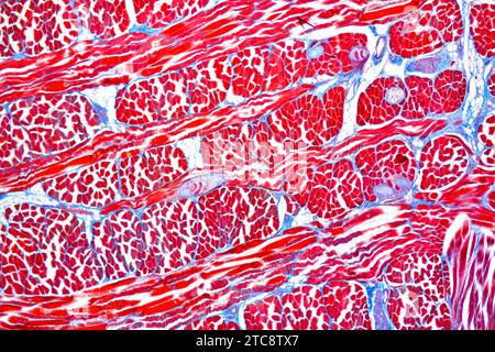 Larves de ver de porc (Trichinella spiralis) dans un tissu musculaire. Microscope optique X50 à 10 cm de large. Banque D'Images