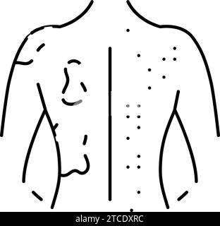 rash lésions cutanées maladie ligne symptôme illustration de vecteur d'icône Illustration de Vecteur