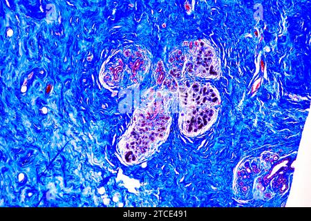 Glande mammaire humaine. Microscope optique X100. Banque D'Images