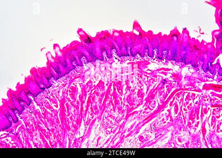 Section de langue montrant des papilles linguales, des papilles gustatives, des muscles striés, des glandes gustatives et des tissus conjonctifs. Microscope optique X100. Banque D'Images