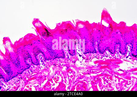 Section de langue montrant des papilles linguales, des papilles gustatives, des muscles striés, des glandes gustatives et des tissus conjonctifs. Microscope optique X200. Banque D'Images