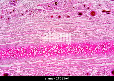 Tissu cartilagineux élastique de l'oreille montrant les chondrocytes, les fibres d'élastine et la matrice. Microscope optique X100. Banque D'Images