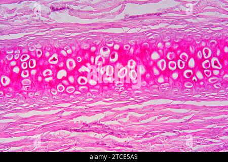 Tissu cartilagineux élastique de l'oreille montrant les chondrocytes, les fibres d'élastine et la matrice. Microscope optique X200. Banque D'Images
