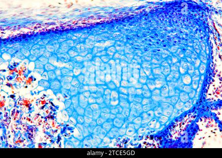 Tissu cartilagineux élastique de l'oreille montrant les chondrocytes, les fibres d'élastine et la matrice. Microscope optique X200. Banque D'Images