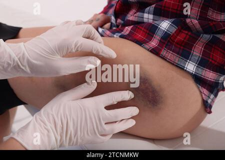 Médecin examinant la hanche contusionnée du patient à l'hôpital, en gros plan Banque D'Images