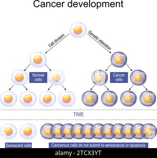 Le développement du cancer. Carcinogenèse ou oncogenèse. Initiation de cellules tumorales. Prolifération cellulaire. Illustration vectorielle Illustration de Vecteur