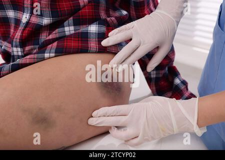 Médecin examinant la hanche contusionnée du patient à l'hôpital, en gros plan Banque D'Images