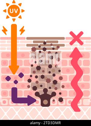 Illustration vectorielle de la façon dont les taches cutanées (hyperpigmentation) sont créées. Illustration de Vecteur