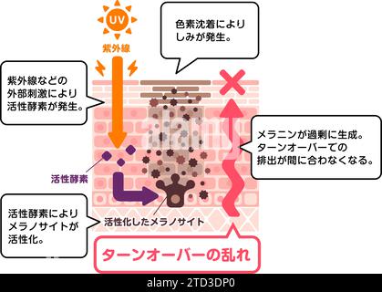 Illustration vectorielle de la façon dont les taches cutanées (hyperpigmentation) sont créées. Illustration de Vecteur