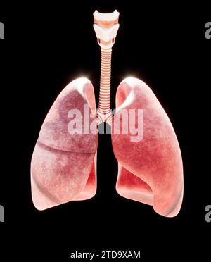 Trachée et arbre bronchique, inflammation provoquant une bronchite. Inflammation aiguë ou chronique. La bronchite virale est causée par un virus et est contagieuse Banque D'Images