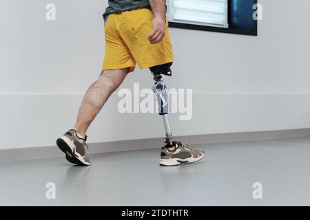 Homme méconnu dans un short jaune portant une jambe prothétique Banque D'Images