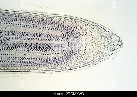 Calyptra ou capuchon de racine protégeant le tissu méristématique de la racine d'oignon. Cellules sur mitose. Banque D'Images