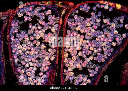 Cône de pin mâle montrant du pollen. Photomicrographe. Banque D'Images