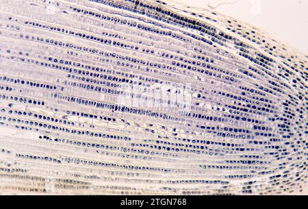 Méristème apical de la racine montrant les divisions cellulaires (mitose) et les cuirs rapides. Photomicrographe de racine d'oignon. Banque D'Images