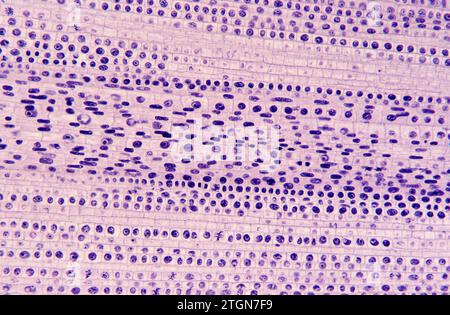 Méristème apical de la racine montrant les divisions cellulaires (mitose). Photomicrographe de racine d'oignon. Banque D'Images