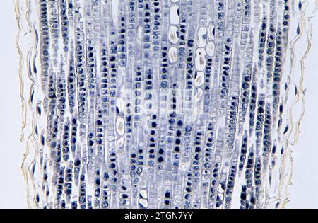 Méristème apical de la racine montrant les divisions cellulaires (mitose) et les cuirs rapides. Photomicrographe de racine d'oignon. Banque D'Images