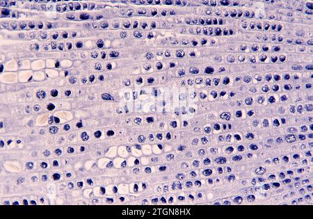 Méristème apical de la racine montrant les divisions cellulaires (mitose) et les cuirs rapides. Photomicrographe de racine d'oignon. Banque D'Images