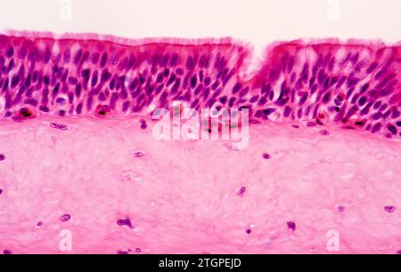 L'épithélium cilié columnaire pseudo-stratifié est une sorte d'épithélium présent sur une trachée. Photomicrographe. Banque D'Images