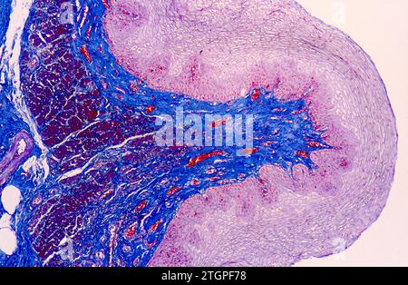 Épithélium squameux stratifié provenant de l'œsophage humain. Photomicrographe. Banque D'Images