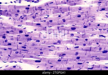 Muscle cardiaque montrant des cellules, nucléous et sarcomères. Photomicrographe. Banque D'Images