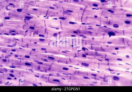 Muscle cardiaque montrant des cellules, nucléous et sarcomères. Photomicrographe. Banque D'Images