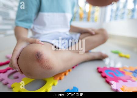 Garçon méconnaissable est assis sur un tapis de bébé en caoutchouc avec un genou cassé. Les soins médicaux aux enfants. Banque D'Images