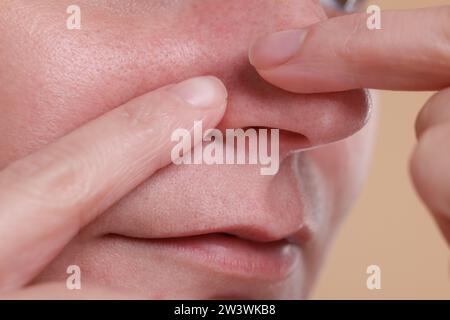 Femme popping bouton sur son nez sur fond beige, gros plan Banque D'Images