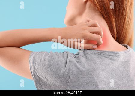 Souffrant d'allergie. Jeune femme grattant son cou sur fond bleu clair, gros plan Banque D'Images