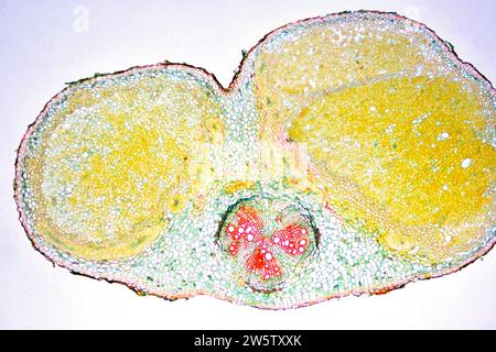 Nodules racinaires avec bactéries nitrifiantes (Bradyrhizobium japonicum) dans le soja (Glycine max). Photomicrographe X20 à 10 cm de large. Banque D'Images