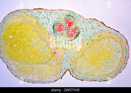 Nodules racinaires avec bactéries nitrifiantes (Bradyrhizobium japonicum) dans le soja (Glycine max). Photomicrographe X20 à 10 cm de large. Banque D'Images