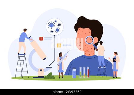 Diagnostic d'une maladie contagieuse infectieuse, la rougeole. Les petites personnes avec la loupe vérifient les symptômes de la rougeole, de l'éruption rouge et du visage de la peau démangeaison dans l'illustration vectorielle de dessin animé de patient d'enfant malade Illustration de Vecteur