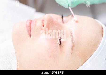 Portrait du visage d'une femme avec la peau à problèmes. Procédure de pelage. Beauté naturelle. Supports mixtes Banque D'Images