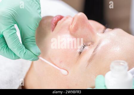 Portrait du visage d'une femme avec la peau à problèmes. Procédure de pelage. Beauté naturelle. Supports mixtes Banque D'Images