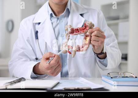 Gastroentérologue montrant le modèle anatomique du gros intestin à table en clinique, gros plan Banque D'Images
