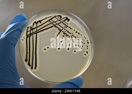 Strie quadrant de la bactérie Staphylococcus aureus cultivée ou inoculée sur une plaque de gélose Baird-Parker avec de la tellurite d'oeuf. Banque D'Images