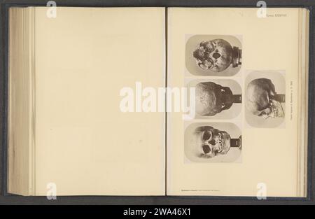 Quatre images d'un crâne d'homme samique, v. 1870 - en 1880 ou avant, en haut à gauche une vue de face, en haut au-dessus, une vue de derrière, une vue de dessous en haut à droite, sous une vue de côté. Support photographique Scandinavie. crâne (humain) imprimé à l'albumine de papier Banque D'Images