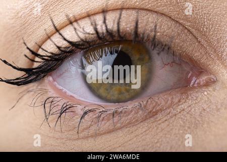 yeux de femme fatigués, gros plan des capillaires éclatés visibles, incarnant le concept de fatigue oculaire. La fatigue. maquillage sur le visage Banque D'Images