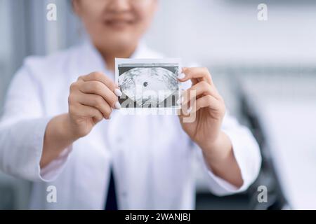 Le médecin tient dans ses mains le résultat d'une échographie d'une femme enceinte. Banque D'Images