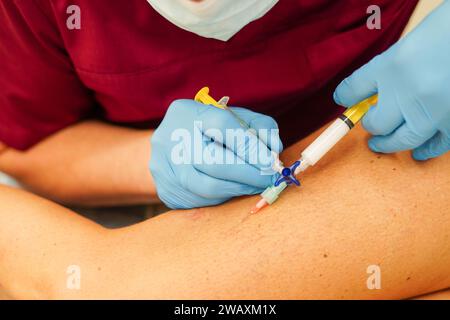 Enlèvement des varices sur les jambes. Docteur en sclérothérapie Banque D'Images