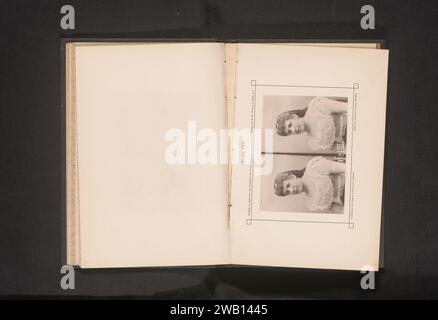 Deux portraits d'une femme inconnue, avec et sans retouche, Geyer & Fischer, c. 1880 - en 1890 ou avant tirage photomécanique de Breslau collotype papier femme adulte Banque D'Images