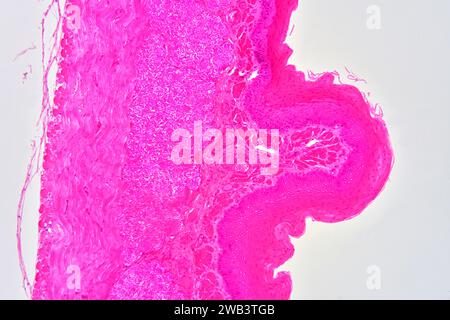 Oesophage humain présentant un tissu conjonctif d'épithélium squameux stratifié non kératifié et un muscle lisse. X75 à 10 cm de large. Banque D'Images