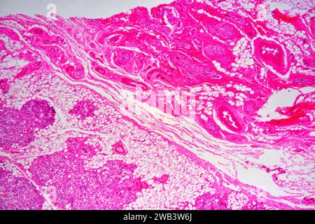 Muqueuse du cordon ombilical humain montrant : glandes muqueuses, tissus conéco-infectieux, adipocytes et vaisseaux sanguins. X25 à 10 cm de large. Banque D'Images