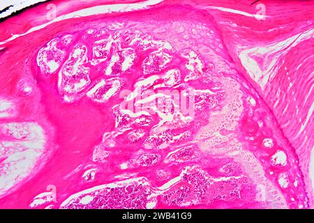 La moelle osseuse (moelle osseuse) est un organe hématopoïétique. Photomicrographe X75 à 10 cm de large. Banque D'Images