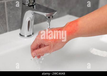 Femme tenant la main brûlée sous l'eau froide à l'intérieur, closeup Banque D'Images