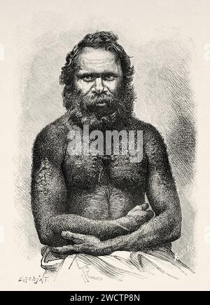 Aborigène australien. Queensland, Australie. Six mois en Australie 1878 par Desire Charnay (1828 - 1915) gravure ancienne du 19e siècle du Tour du monde 1880 Banque D'Images