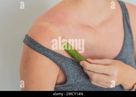 Femme enceinte apaise la peau brûlée par le soleil avec la feuille d'aloès, embrassant le soulagement naturel pendant la grossesse Banque D'Images