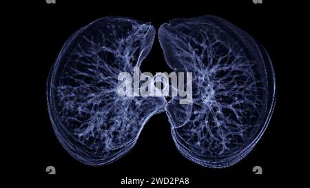 Image CT thorax or Lung 3D montrant la trachée et le poumon dans le système respiratoire. Banque D'Images